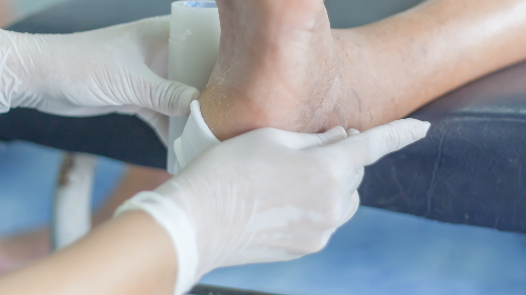 Diabetic Foot Care: How to Treat Dry, Peeling Skin Safely
